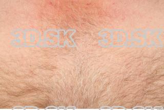 Skin texture of Drew 0001